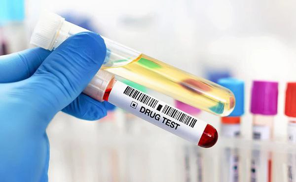 Now Drug Testing Mandatory for Applicants to Kuwait Government Jobs